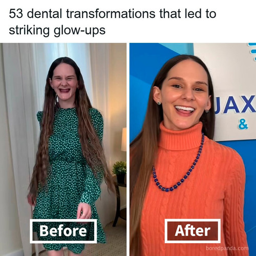 dental implants.jpg