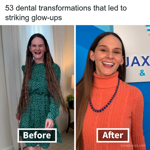 dental implants.png