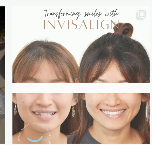 teeth retainer Damansara uptown.png