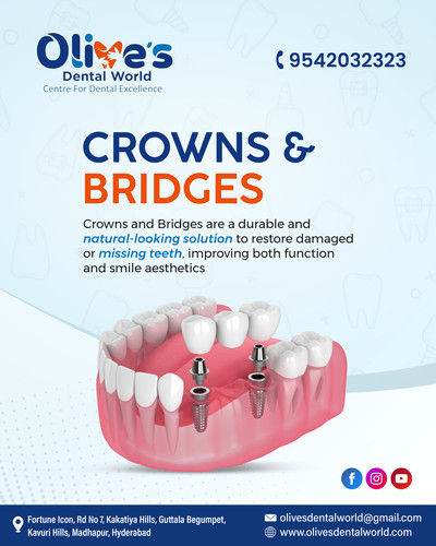 Protect and Restore Teeth with Custom Crowns and Bridges.jpg