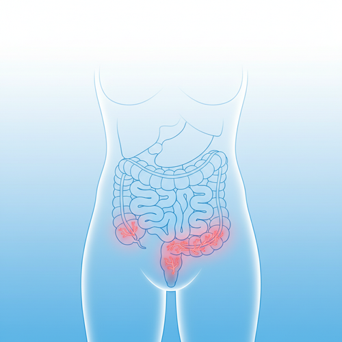 pinterest diarrhea hemorrhoids 1770902140184.png