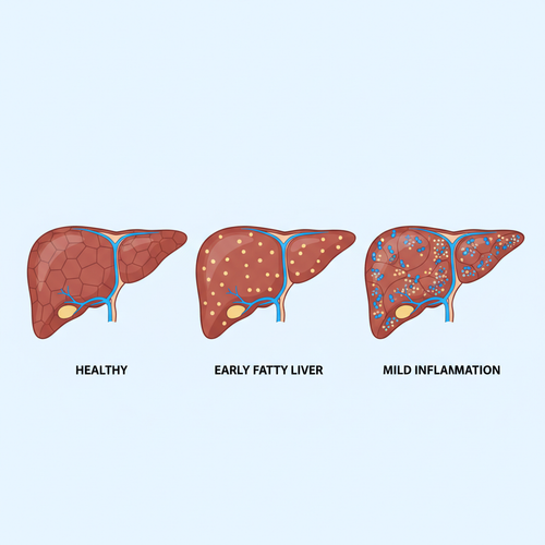 pinterest liver disease 1770905142514.png