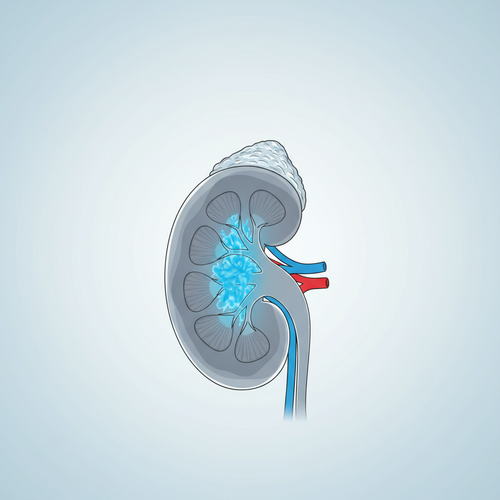 pinterest kidney tumor 1770933336071.png