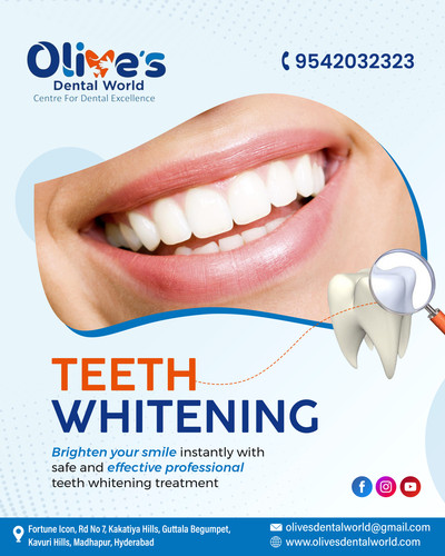 Why Choose Professional Teeth Whitening in Madhapur?.jpg
