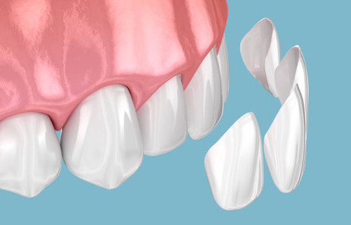 Are you looking to enhance your smile with a natural, flawless appearance? Our dental practice in Park Ridge, IL specializes in high-quality, natural-looking veneers that blend seamlessly with your teeth.

Learn More- https://dentistinparkridge.com/veneers/