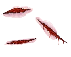 wound.png