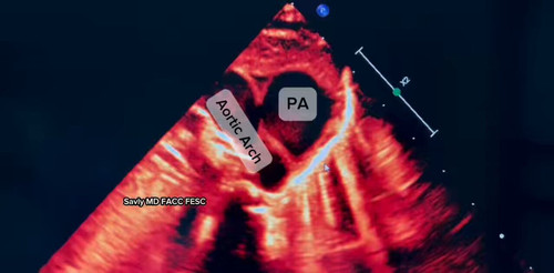 99jSarluCCzvl lg.jpg