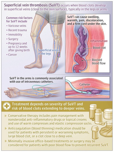 HA seduXkAA7sGR?format=jpg.jpg