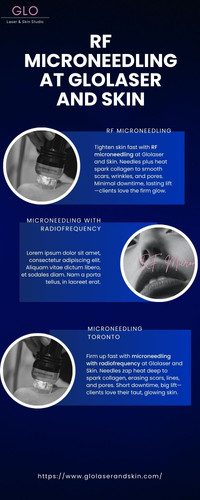 RF Microneedling at Glolaser and Skin.jpg