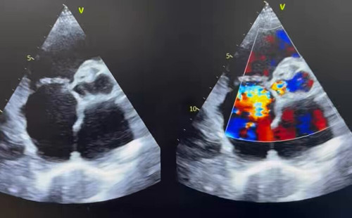 qiVorbAqB sTL jw.jpg