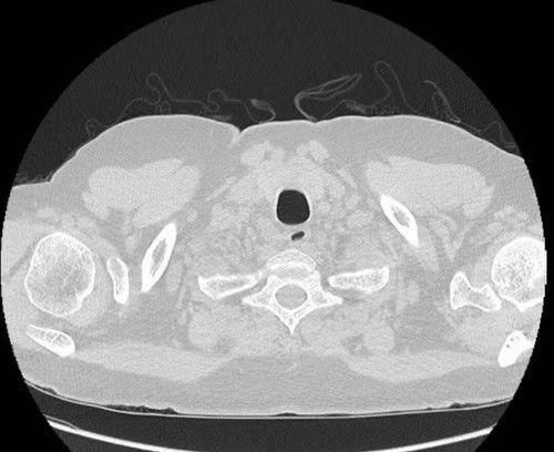 W LFxhuhsF HIdti.jpg