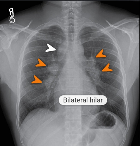 HBK5QEuakAACOd1.jpg