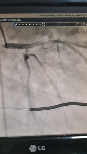 gjyST1K9s fs6ITc.jpg