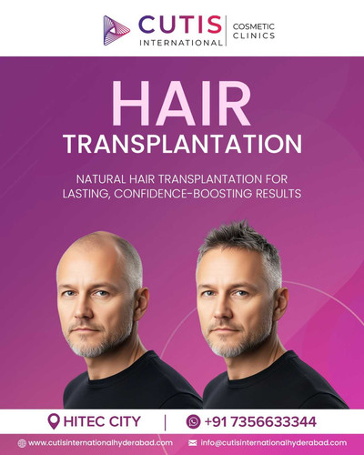 Is Hair Transplantation safe.jpg