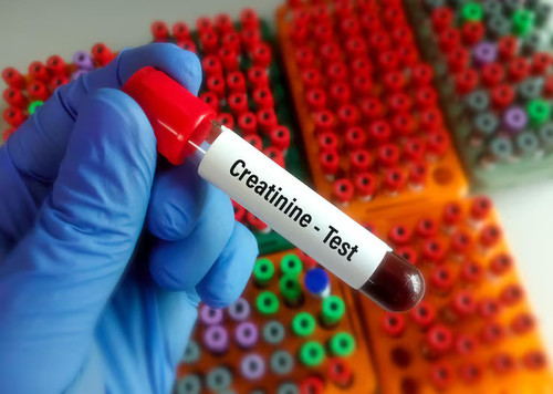 Creatinine.jpg