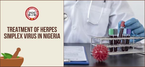 Treatment of Herpes Simplex Virus in Nigeria - Bhagwati Ayurved.jpg