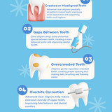 Common Dental Problems That Advanced Clear Aligners Can Fix