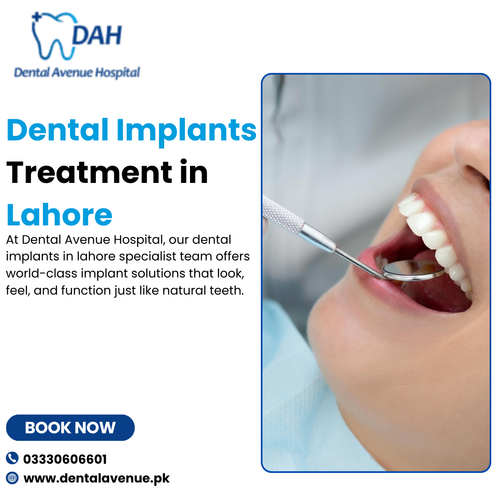 Dental Implants Treatment in Lahore.png