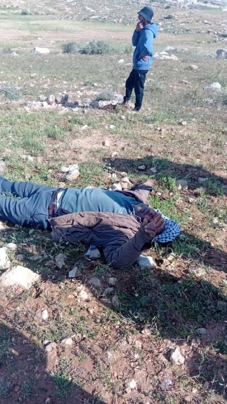 إصابة المواطن حبيب العدره في منطقة خلة عميره بمسافر يطا بعد اعتداء المستوطنين عليه خلال مهاجمة المنطقة...