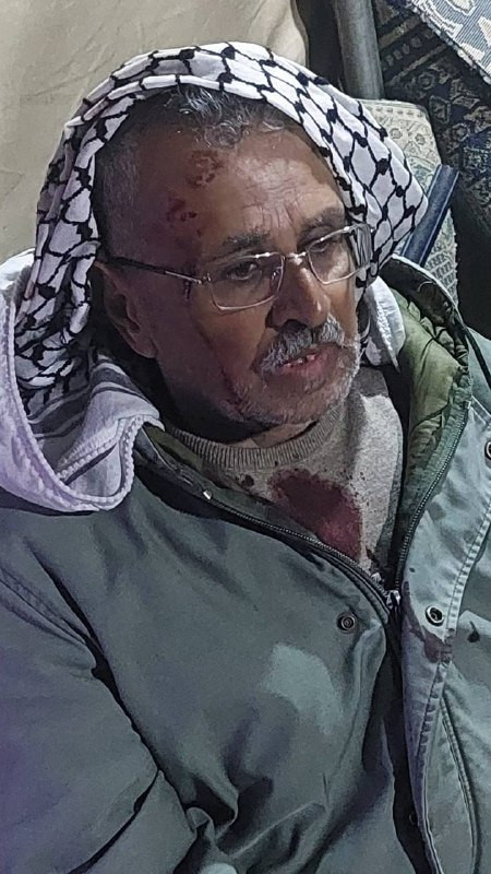 صورة| هاجم مستوطنون مع ساعات المغرب رعاة أغنام في خربة الفخيت بمسافر يطا، ما أدى لإصابة المواطن محمد حمد أبوصبحه في الرأس وإصابة آخر برضوض، كما حاولوا...