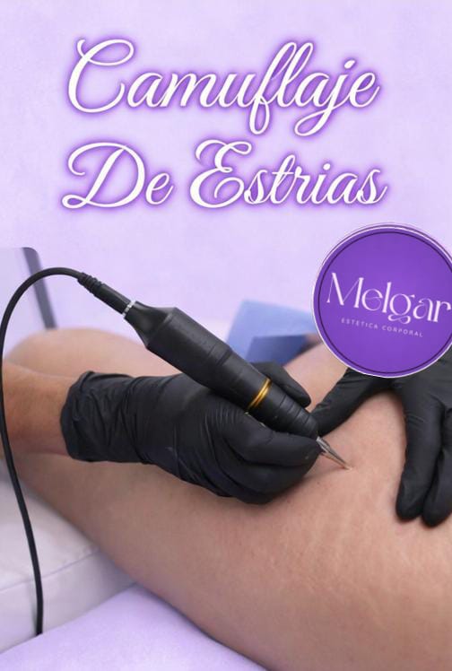 Camuflaje de estrías y cicatrices