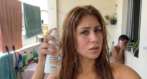 Peptídeos Biomiméticos e Proteção UV Capilar: Fim do Dano Solar?