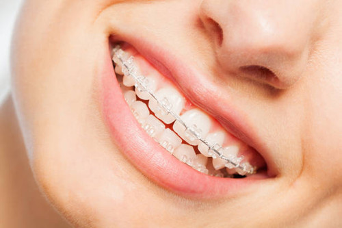 A healthy, straight smile can improve both your confidence and your oral health. At our dental clinic, we proudly provide professional braces treatment in Middletown, NY for children, teens, and adults. Our experienced dental team uses modern orthodontic techniques to correct crooked teeth, bite issues, and spacing problems while ensuring a comfortable treatment experience.

Learn More- https://www.ocortho.net/treatments
