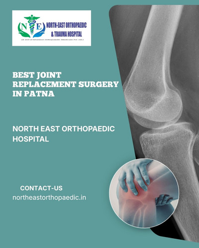 Best Joint Replacement Surgery in Patna: North East Orthopaedic Hospital.jpg