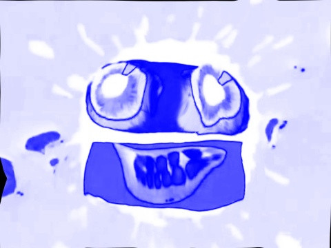 Fat Pad.jpg
