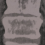 temp.png