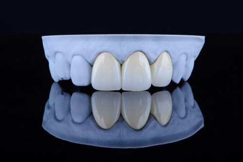 Front Dental Crown for Seamless Tooth Repair.jpg