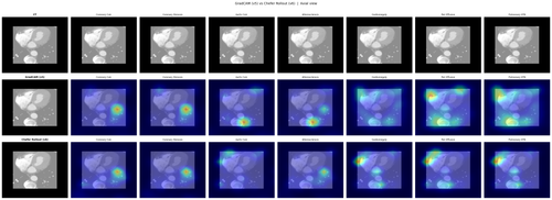 sample CTA v5v6 compare Axial.png