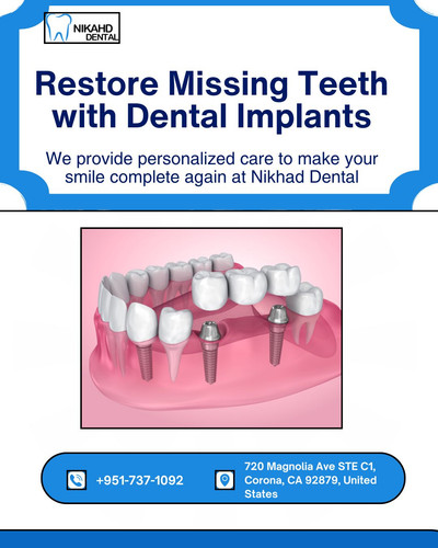 Restore Missing Teeth with Dental Implants.jpg