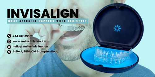 INVISALIGN WHAT ACTUALLY HAPPENS WHEN YOU START.jpg