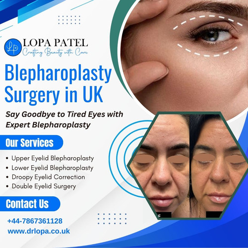 Blepharoplasty Surgery in UK (1).jpg