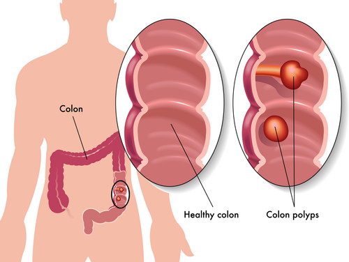 deenie leons inner health center colon hydrotherapy treatment colon cleanse studio city woodland hil.jpg