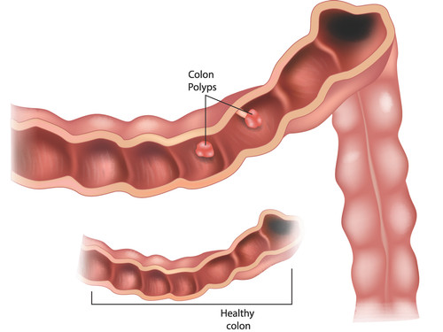 inner health center inc colon hydrotherapy woodland hills colon hydrotherapy treatment woodland hill.jpg