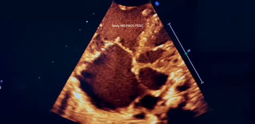 YE Ndj 1v2kKj uD.jpg