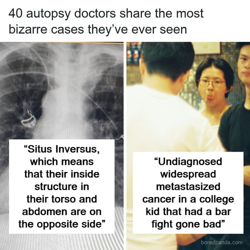 weird autopsy findings found decedents.jpg