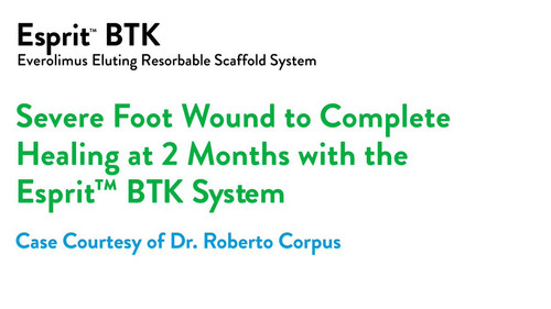 HBOIm fW0AA LDR.jpg