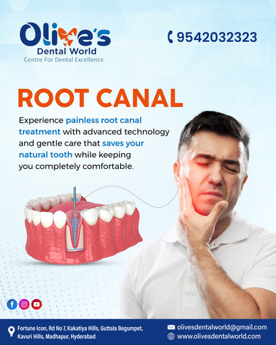 Worried about pain? Try painless root canal care in Madhapur.jpg