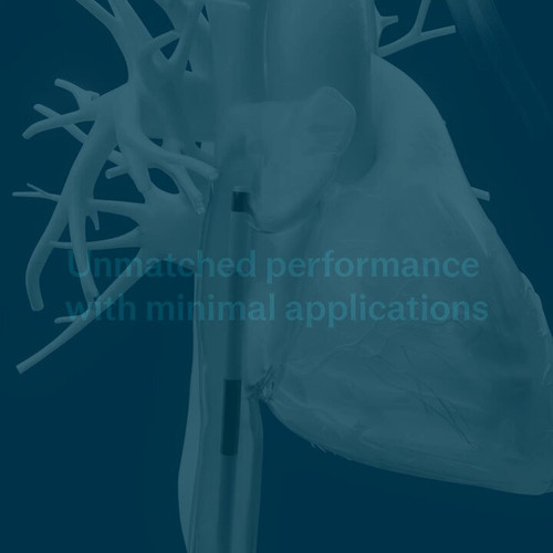 d361DYyx8OoMf iZ.jpg