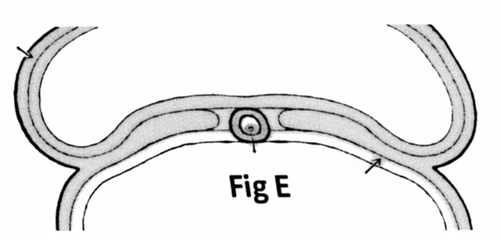 embryologie emd 2021 ce 0003 nbp.png