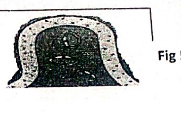 embryologie emd 2020 ce 0004.png