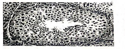 embryologie emd 2020 ce 0013.png