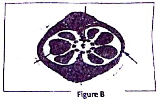 embryologie emd1 2018 ce 0003.png