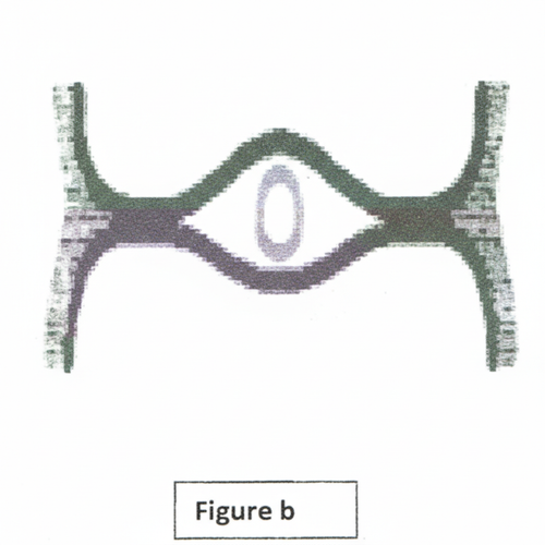 embryologie emd2 2016 ce 0004 nbp.png