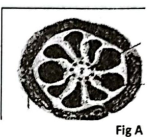 embryologie emd 2021 ce 0006.png