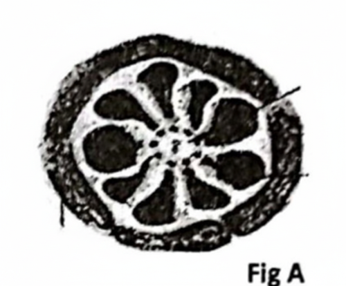 embryologie emd 2021 ce 0006 nbp.png