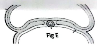 embryologie emd 2021 ce 0003.png
